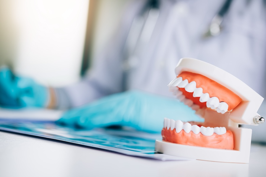 Kiefermodell auf dem Behandlungsplatz – Funktionstherapie in der Zahnarztpraxis Markt 16 Leipzig, Dr. Franziska Höhne.